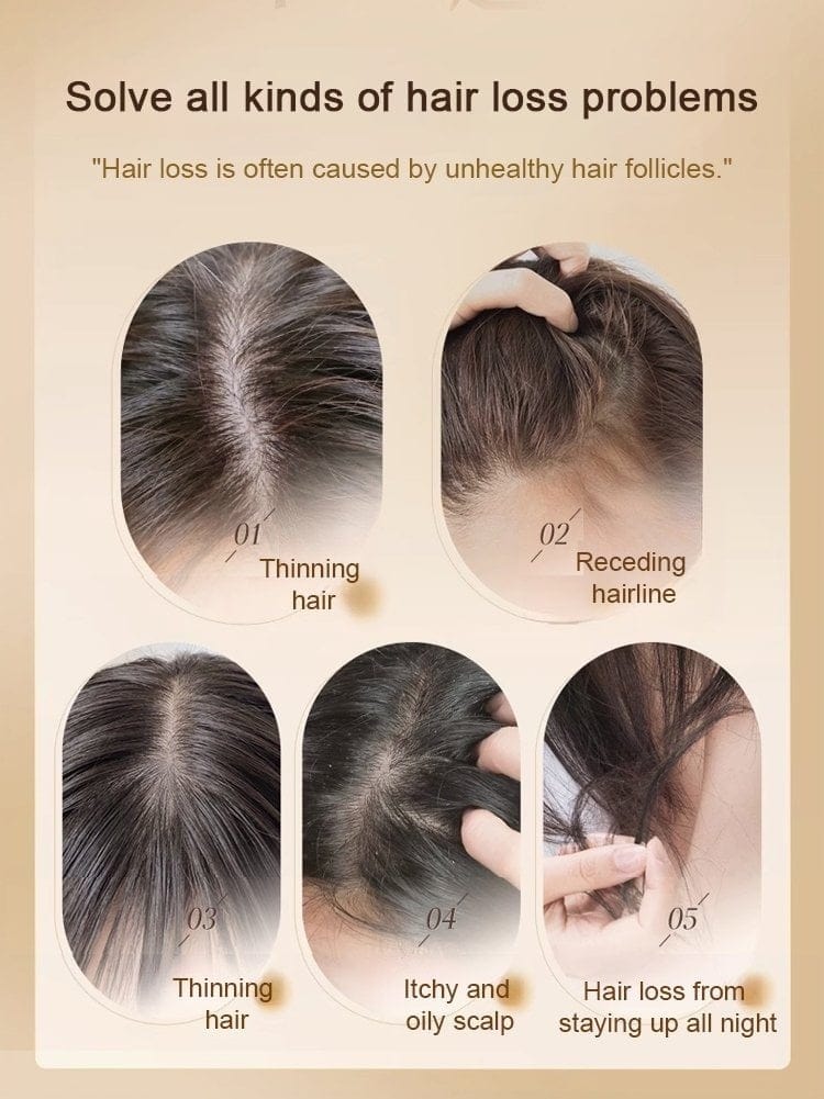 Gingerra™️Ginger Extract Anti-Hairfall Shampoo (Pack of 3)